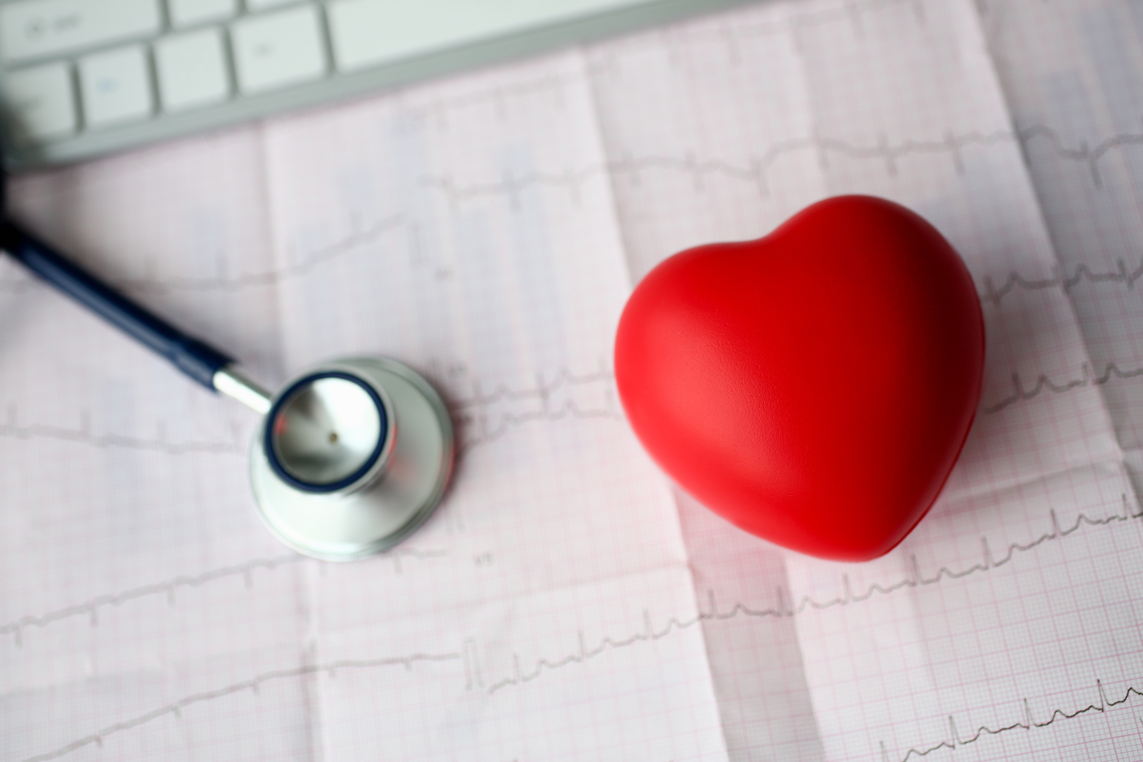 arrhythmia