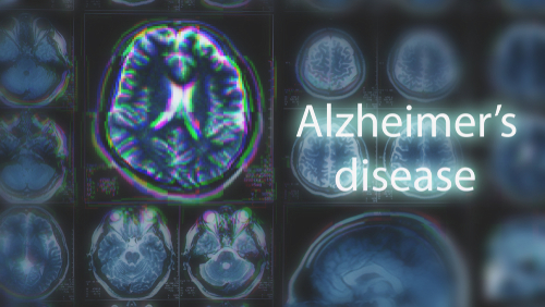 Aduhelm FAQ