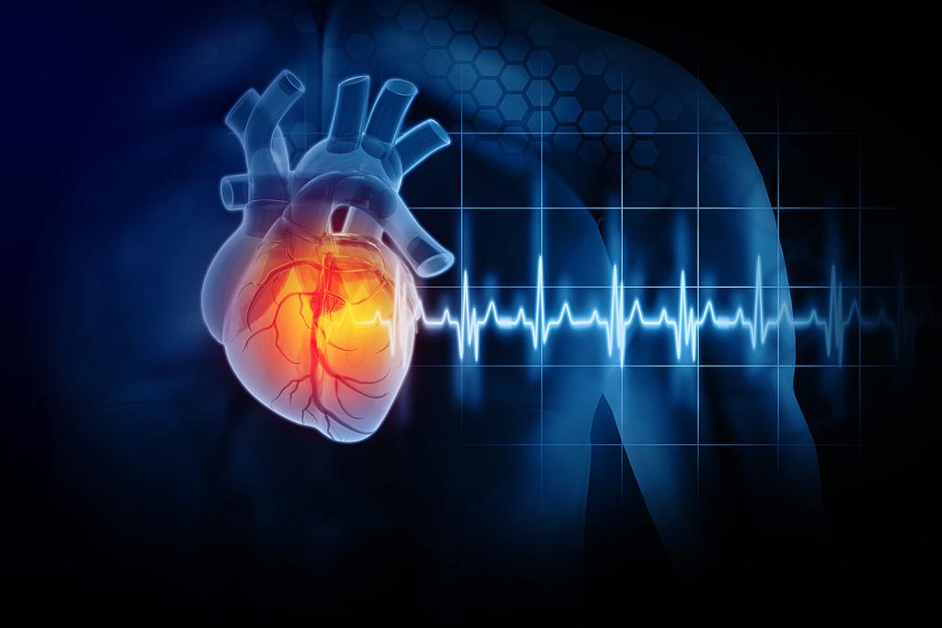 Diagram of an enlarged heart
