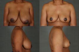 Momeni_B_059_1.jpg