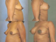 Momeni_B_525_1.jpg